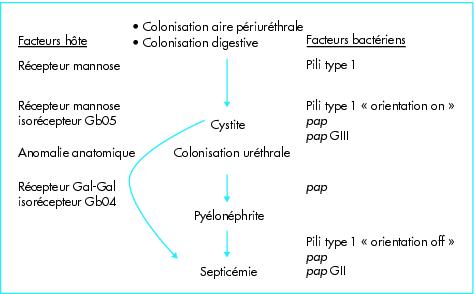 infection urinaire